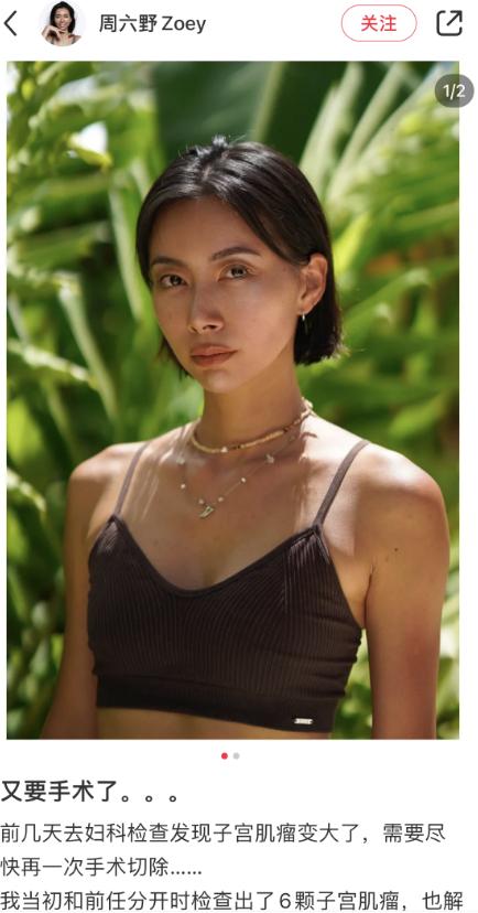 博主周六野自曝患病,因前男友长六颗子宫肌瘤!呼吁女生爱惜自己