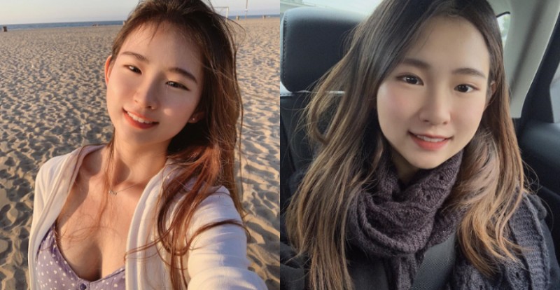 超萌準牙醫「Angela」可愛氣質讓人戀愛　有了她都不用麻醉了